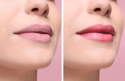Image of Collage with photos of woman with dry and moisturized lips, closeup