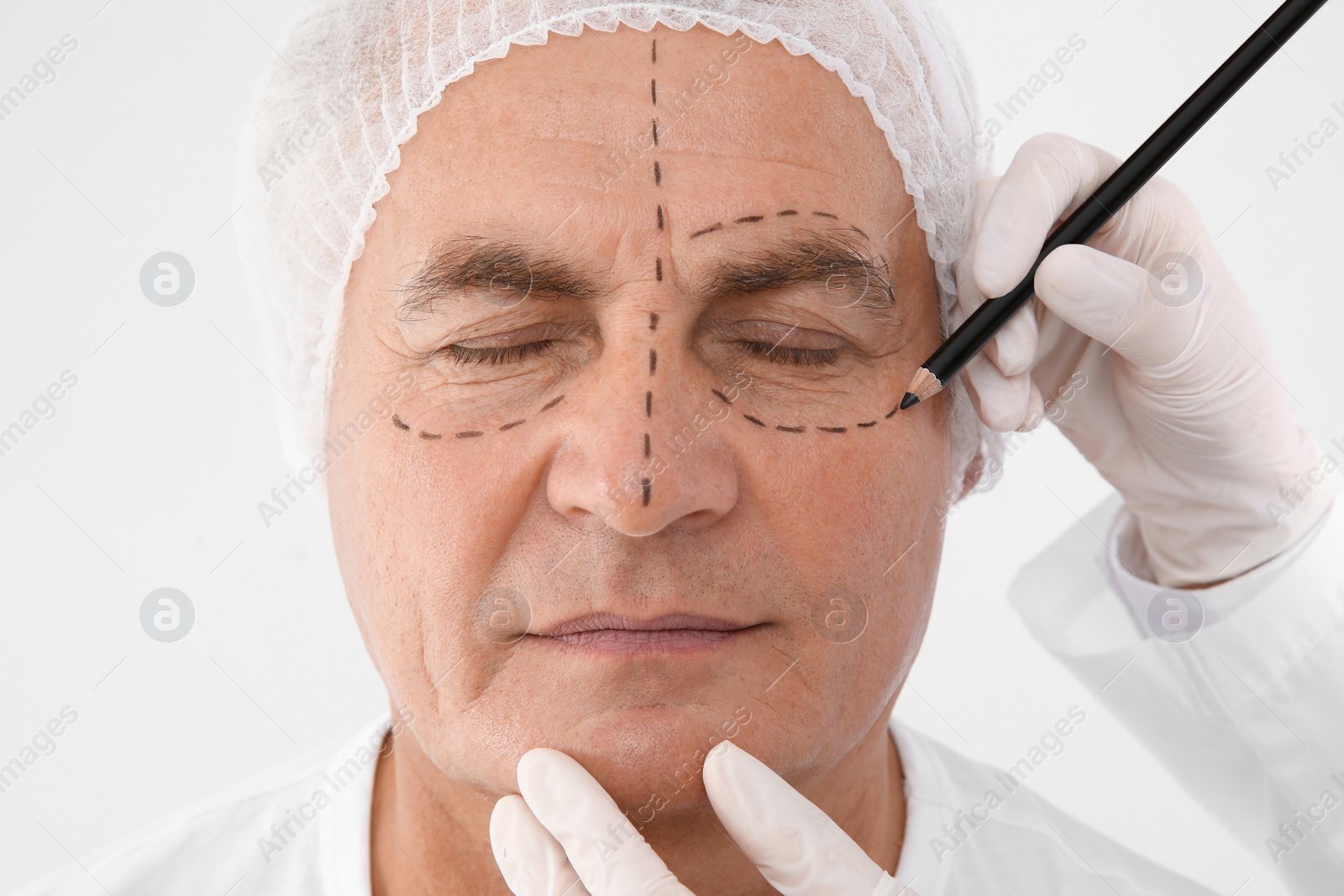 Photo of Doctor marking senior man face before cosmetic surgery on white background