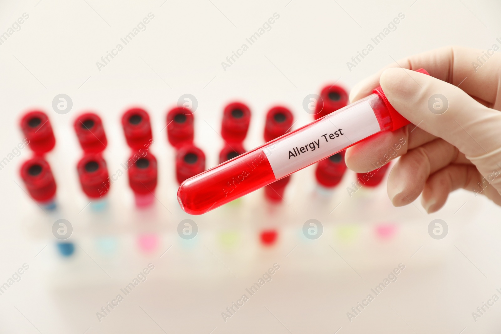 Photo of Doctor holding tube with label ALLERGY TEST over table, closeup