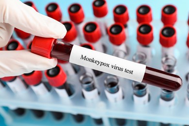 Monkeypox virus test. Laboratory worker holding sample tube with blood near rack, closeup