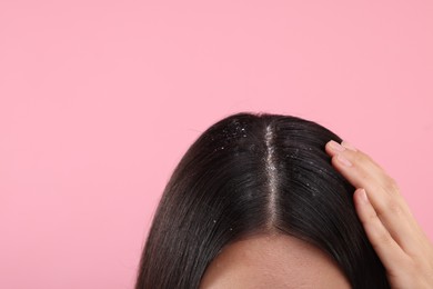 Woman with dandruff in her dark hair on pink background, closeup. Space for text