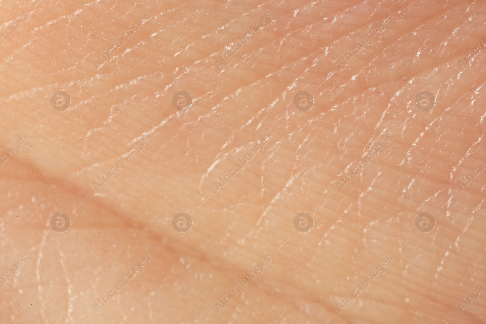 Photo of Texture of dry skin as background, macro view