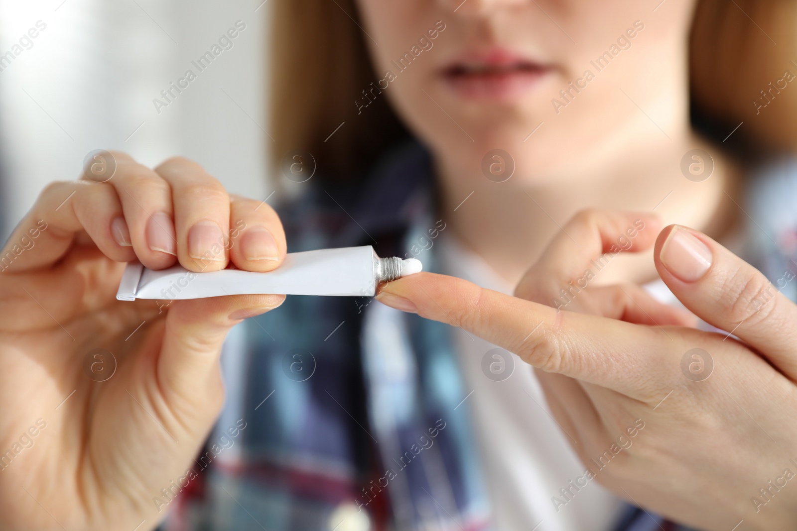 Photo of Woman with herpes applying cream against light background, closeup