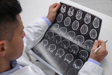 Photo of Doctor examining MRI images of patient with multiple sclerosis at white table, closeup