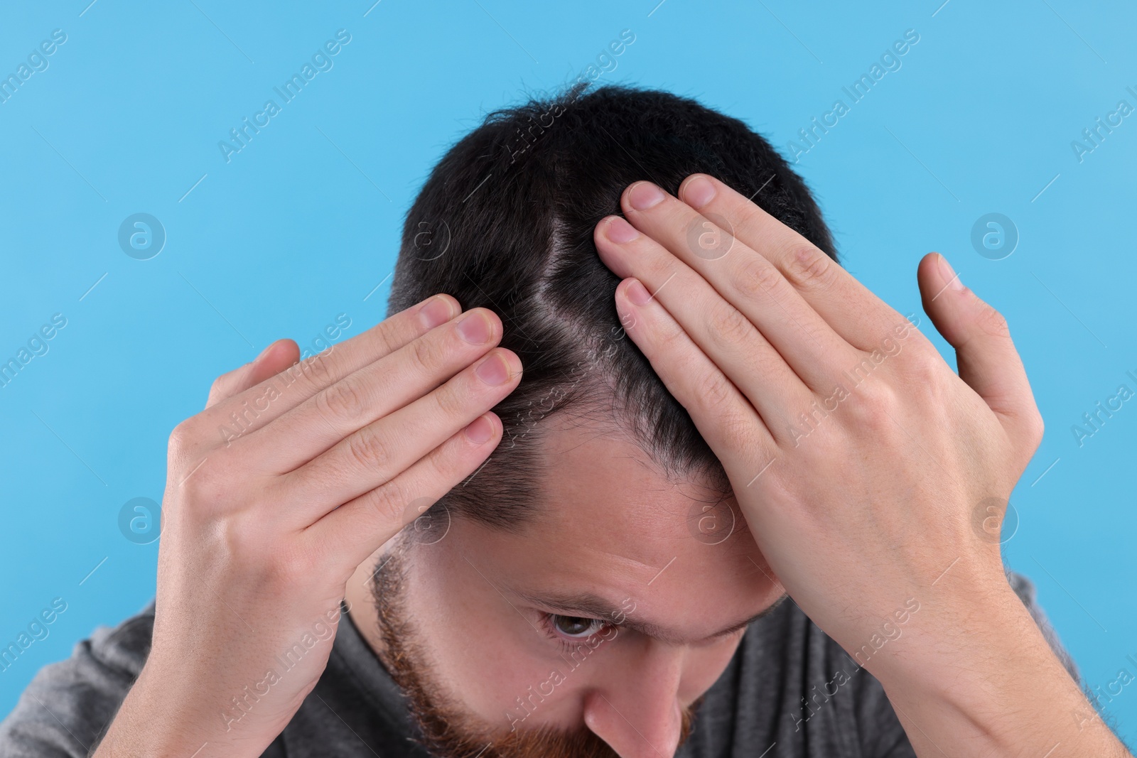 Photo of Man examining his hair and scalp on light blue background, closeup