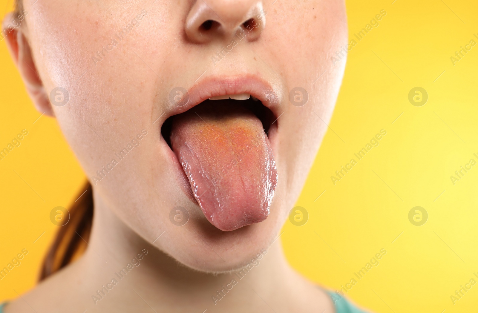 Photo of Gastrointestinal diseases. Woman showing her yellow tongue on color background, closeup