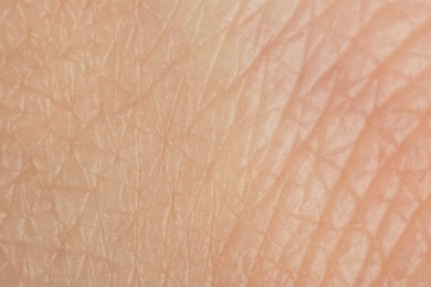 Photo of Texture of healthy skin as background, macro view