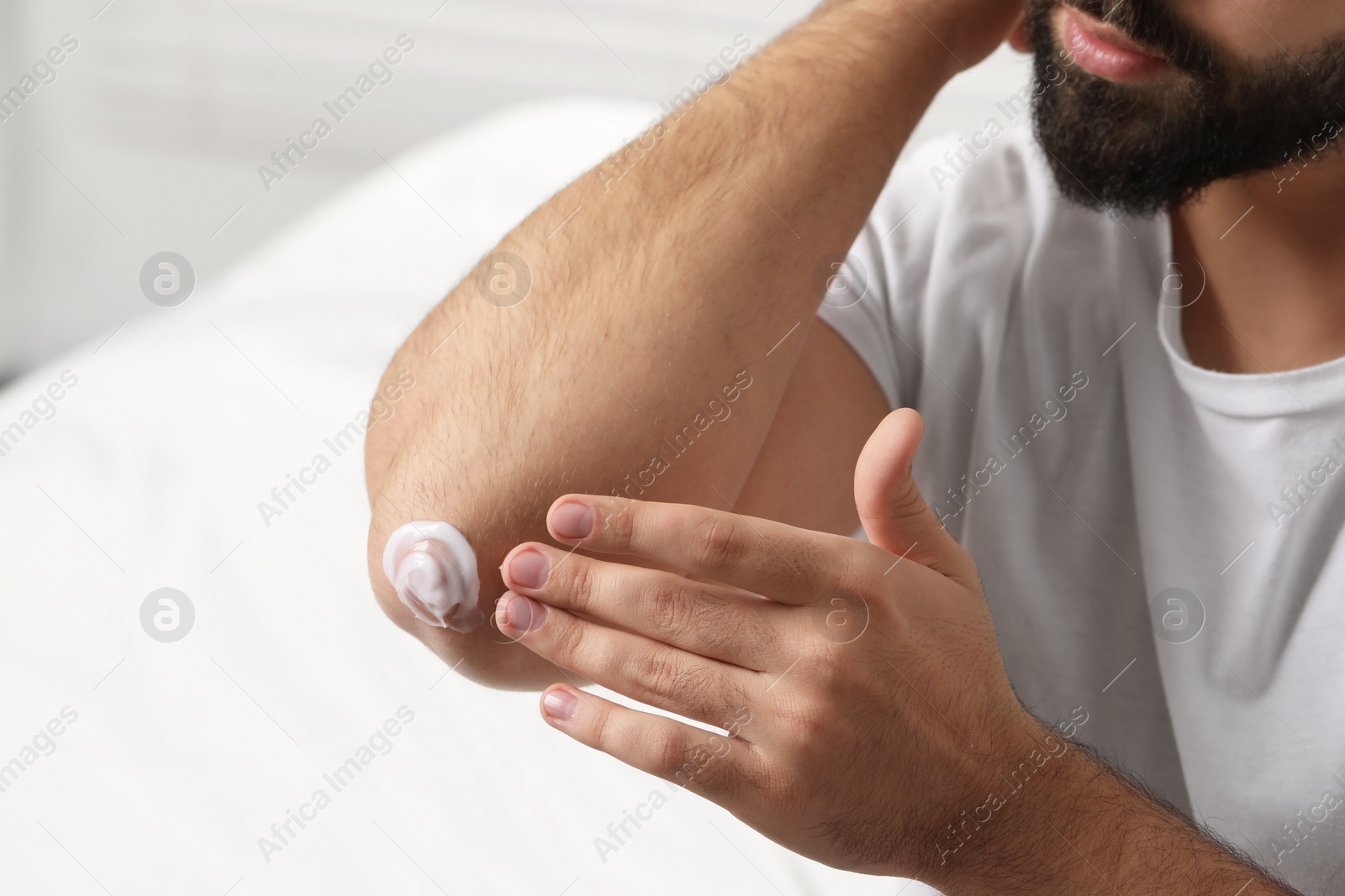 Photo of Man with dry skin applying cream onto his elbow on light background, closeup