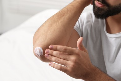 Man with dry skin applying cream onto his elbow on light background, closeup