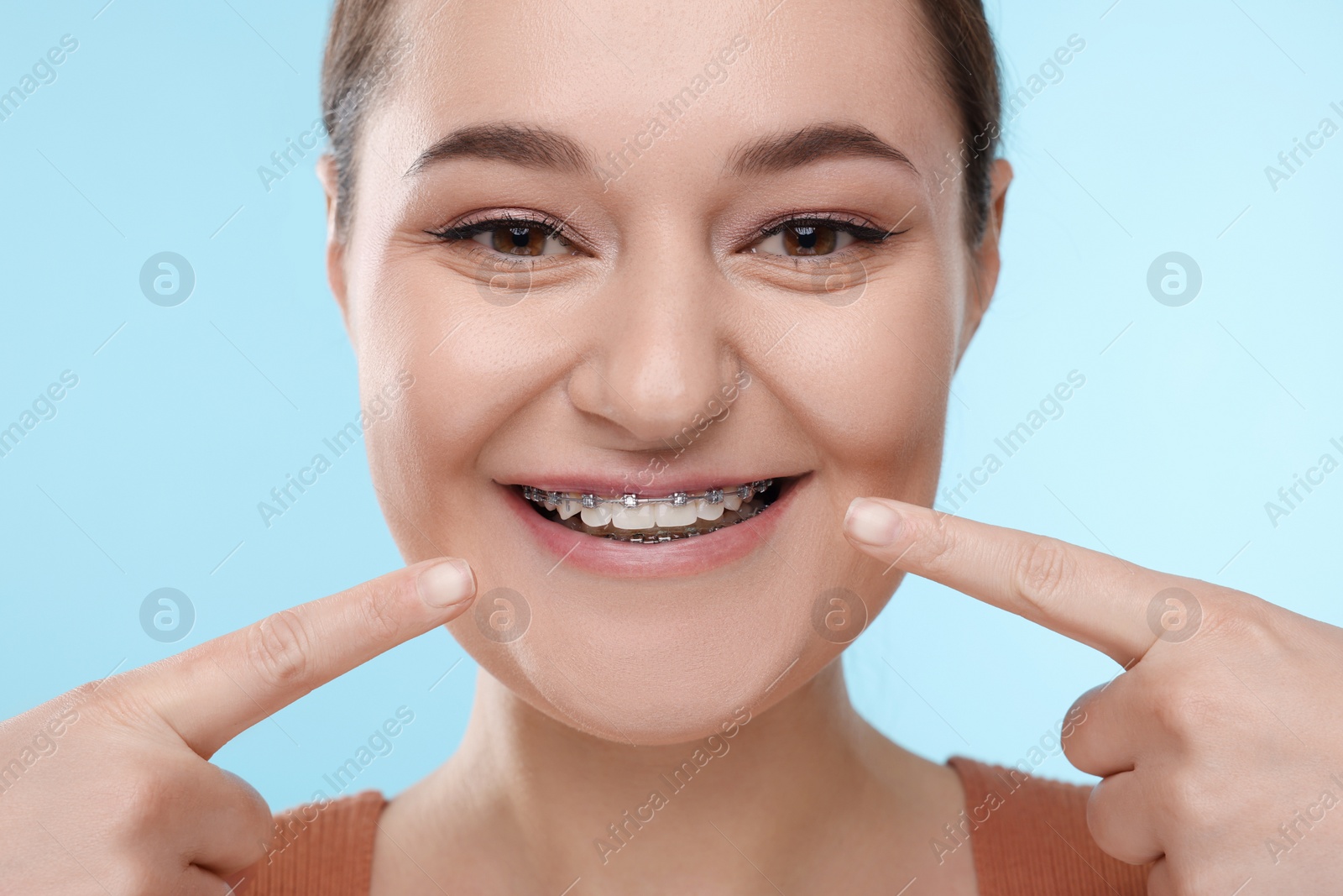 Photo of Smiling woman pointing at braces on her teeth against light blue background, closeup