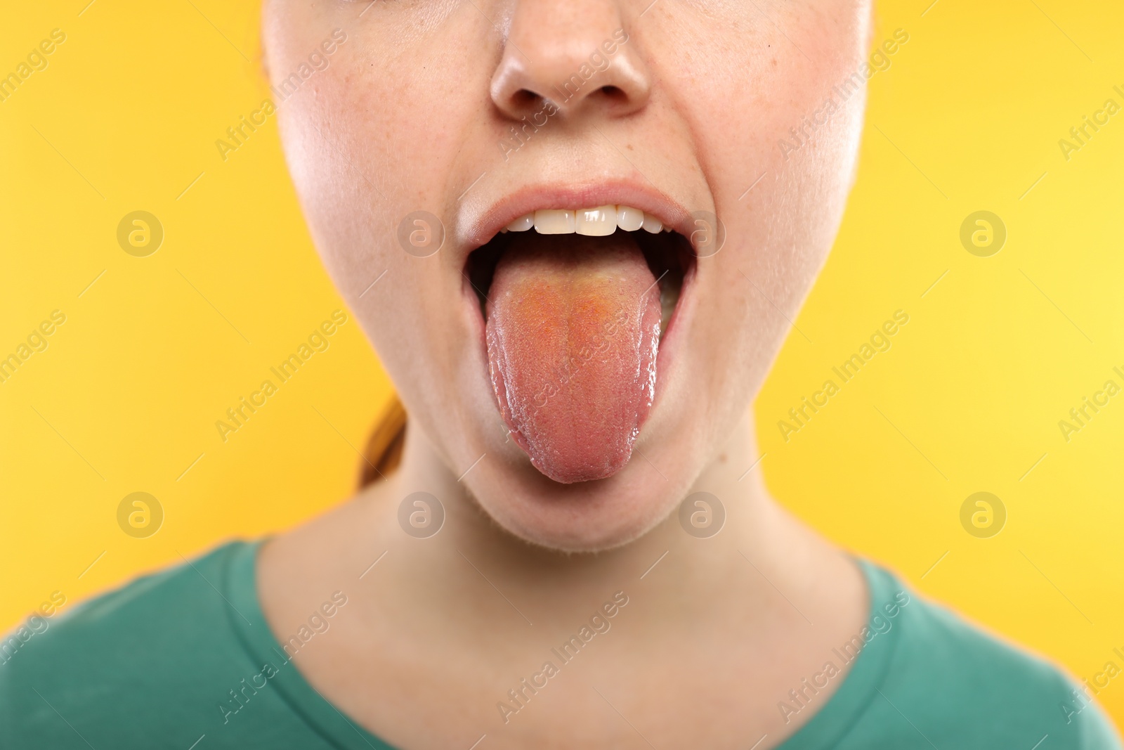 Photo of Gastrointestinal diseases. Woman showing her yellow tongue on color background, closeup