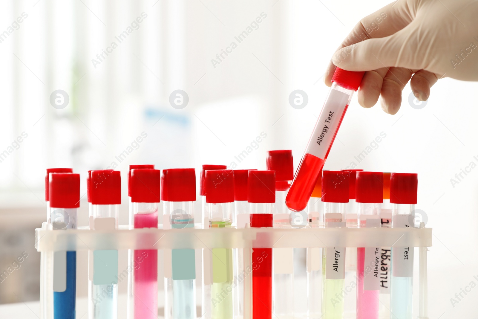 Photo of Doctor holding tube with label ALLERGY TEST over table, closeup