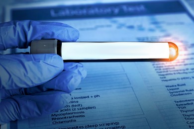 Laboratory worker holding test tube with blood sample over medical form, closeup. Color toned