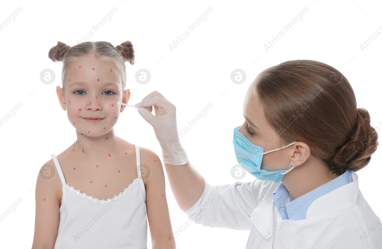 Photo of Doctor applying cream onto skin of little girl with chickenpox against white background. Varicella zoster virus