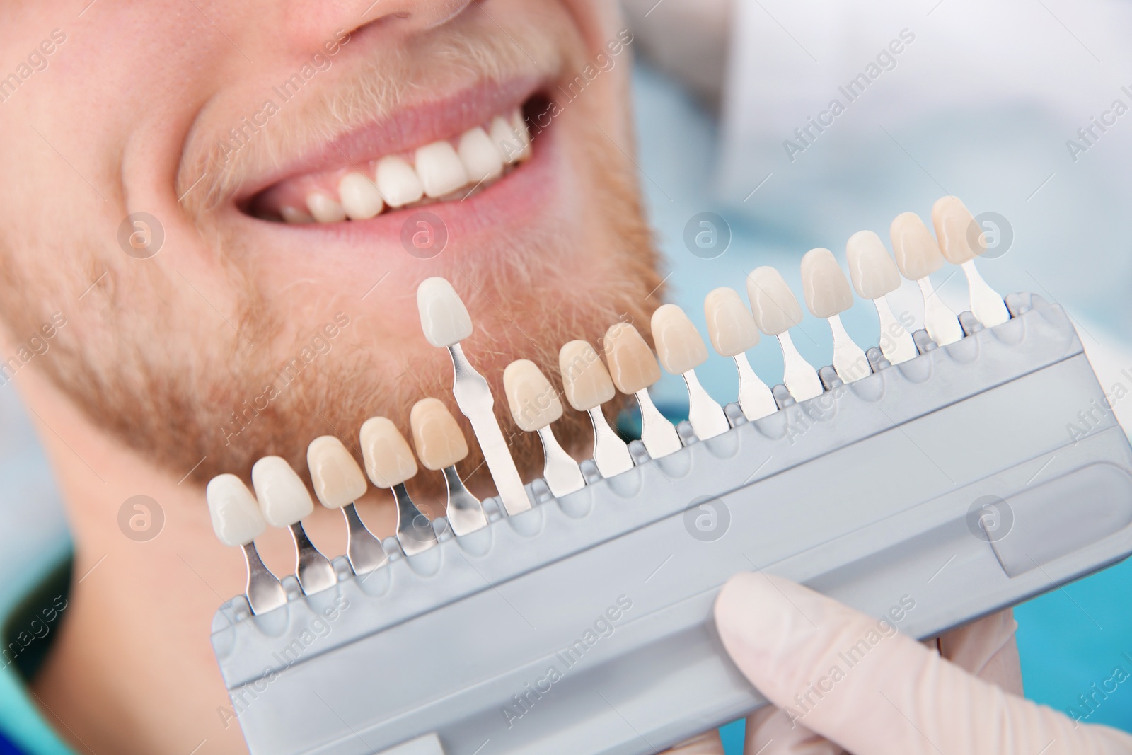 Photo of Dentist selecting patient's teeth color with palette in clinic, closeup