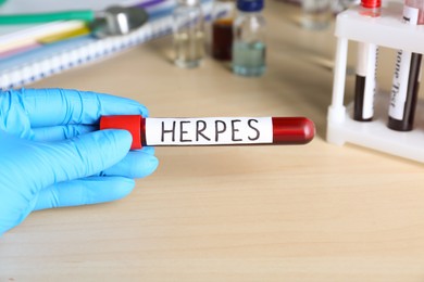 Photo of Doctor in glove holding test tube with word Herpes at wooden table, closeup