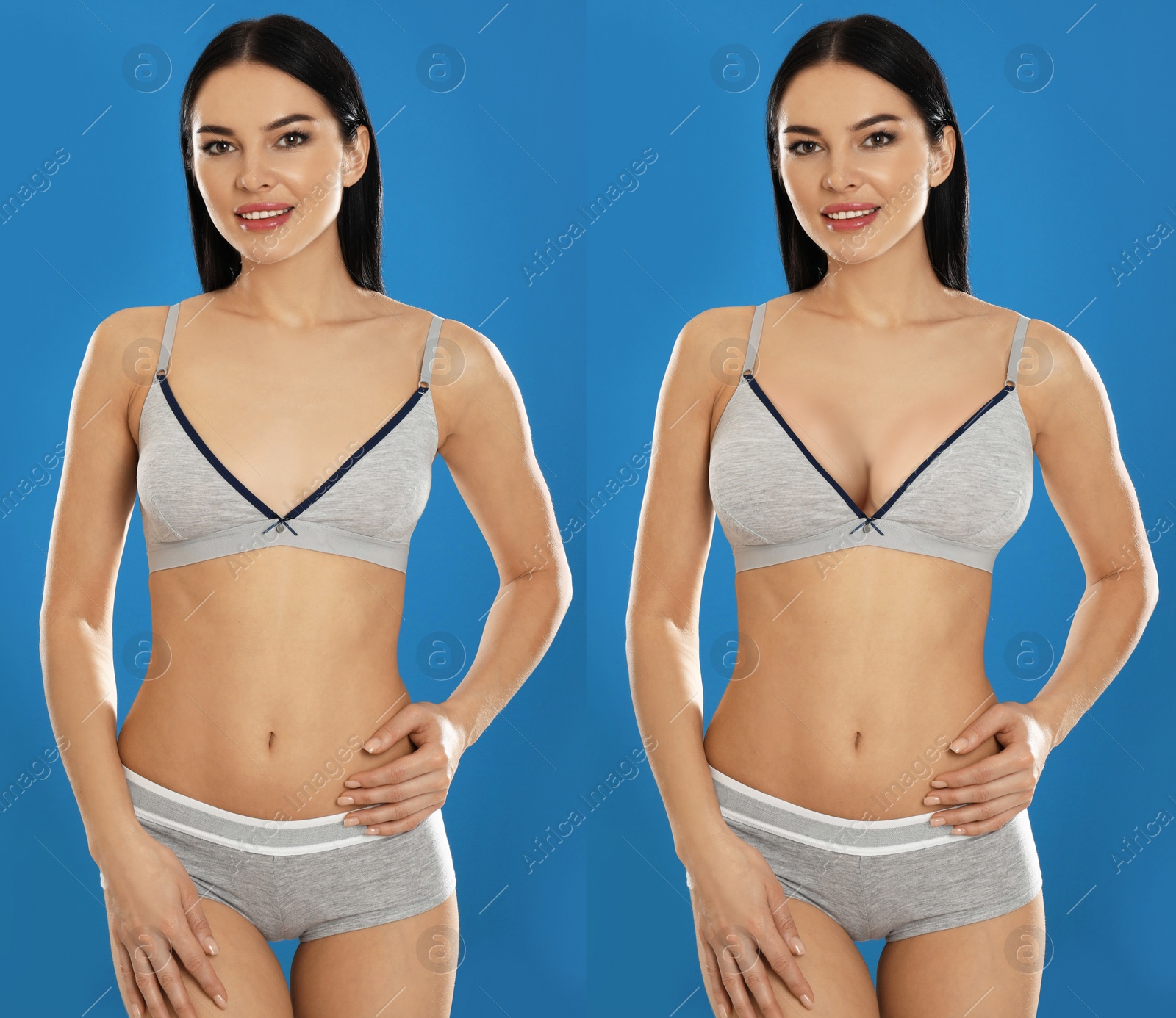 Image of Collage with photos of young woman before and after breast size correction on blue background 