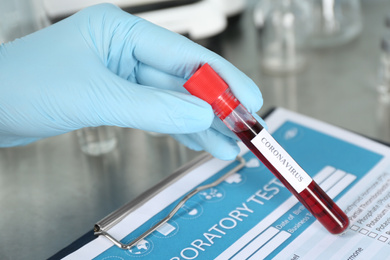 Doctor holding test tube with blood sample and label CORONAVIRUS in laboratory, closeup of hand