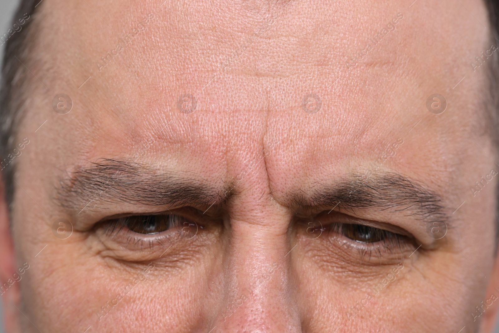 Photo of Closeup view of man with wrinkles on his forehead