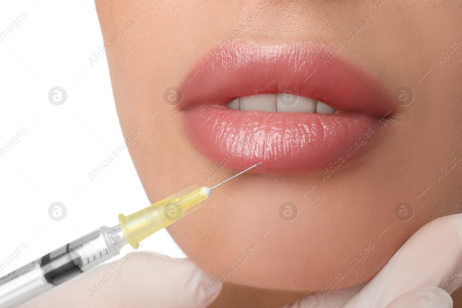 Photo of Woman getting lip injection on white background, closeup