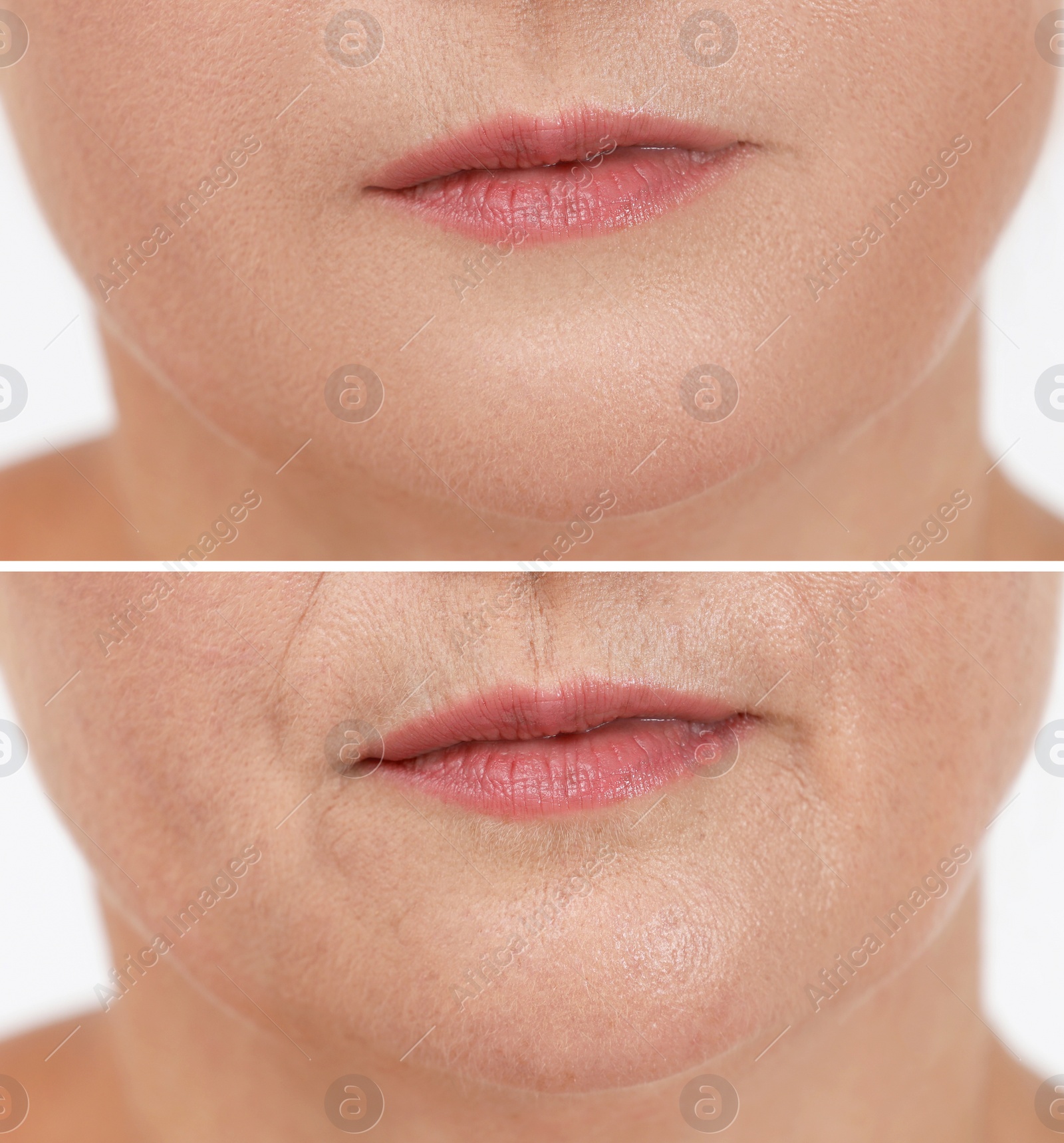 Image of Collage with photos of mature woman having dry skin problem before and after moisturizing, closeup