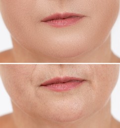 Image of Collage with photos of mature woman having dry skin problem before and after moisturizing, closeup