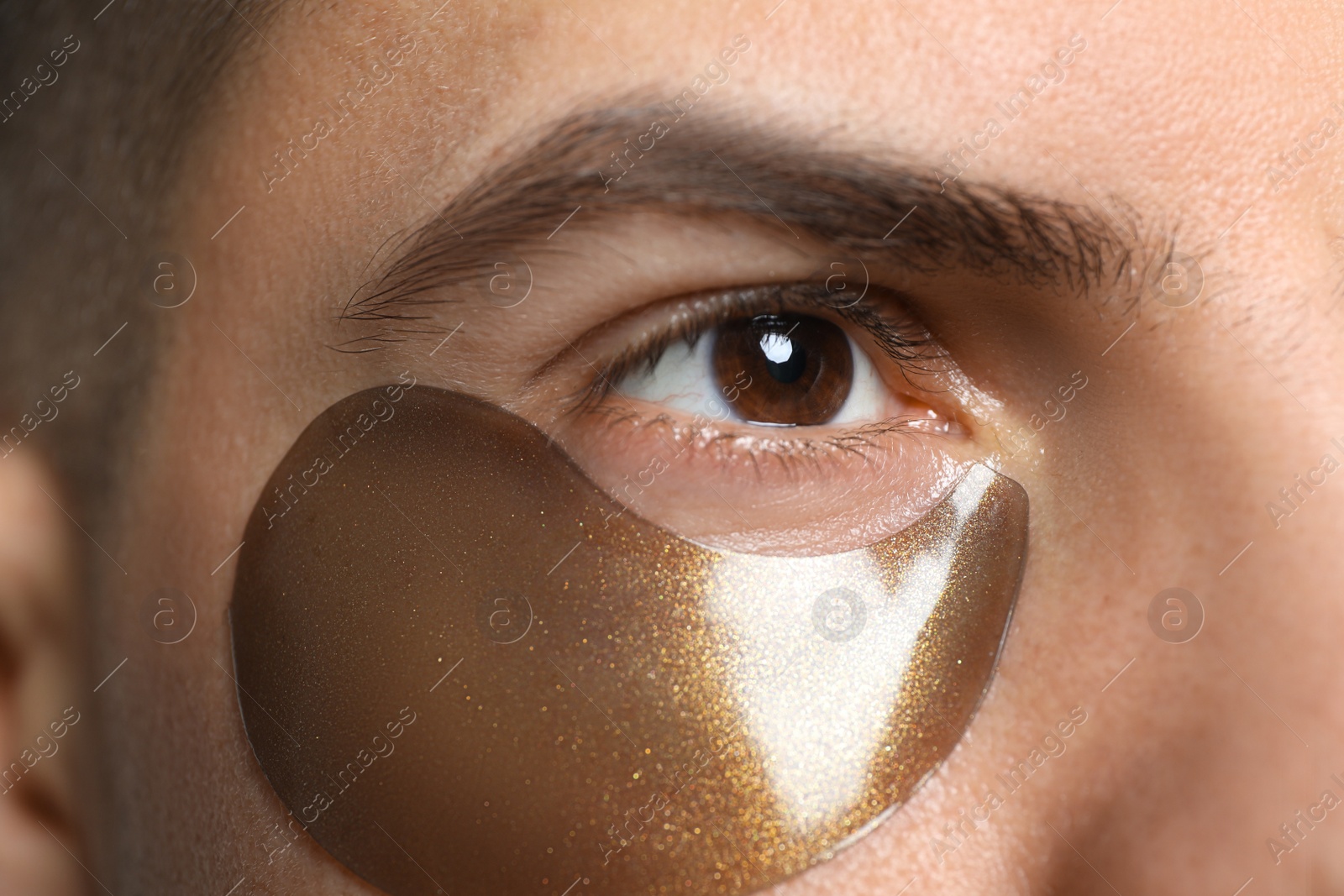 Photo of Man with dark under eye patch, closeup