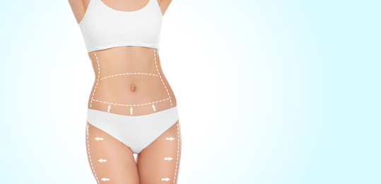Image of Slim young woman with marks on body for cosmetic surgery operation against light background, closeup. Banner design
