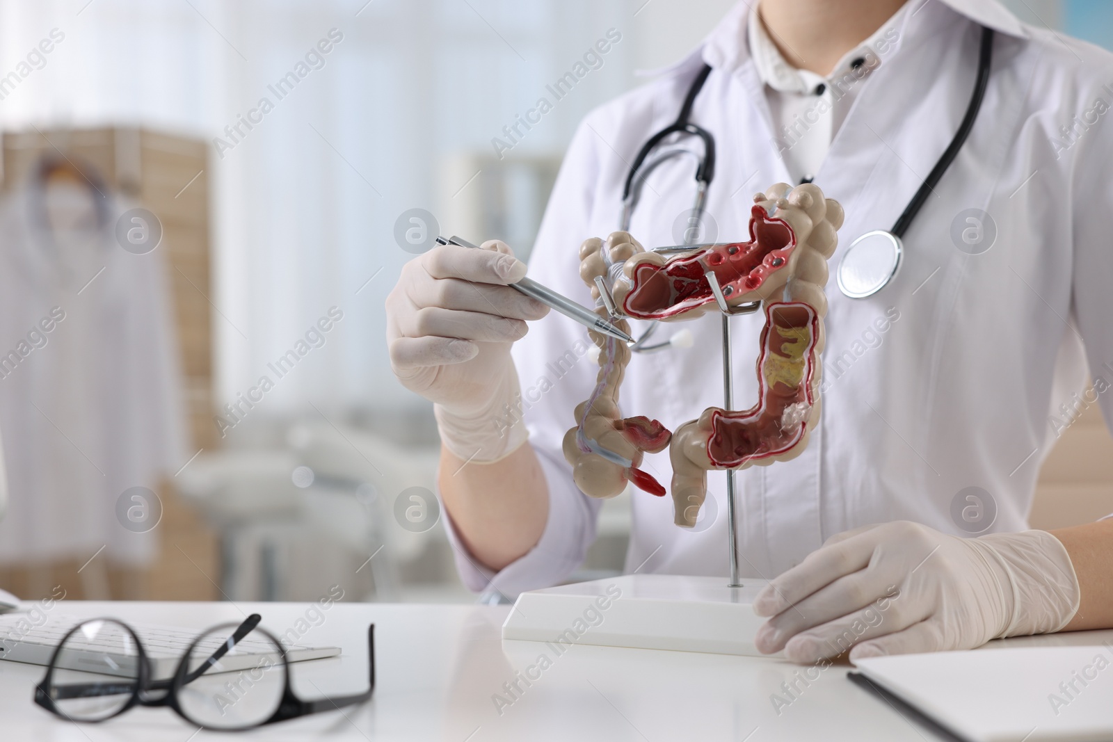 Photo of Gastroenterologist showing anatomical model of large intestine at table in clinic, closeup