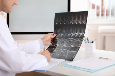 Orthopedist examining X-ray picture at desk in office, closeup