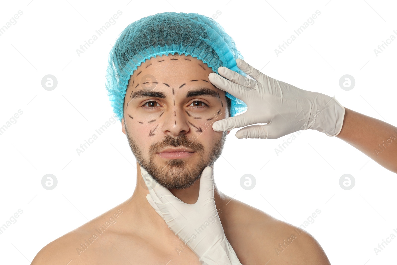 Photo of Doctor examining man's face with marker lines for plastic surgery operation on white background