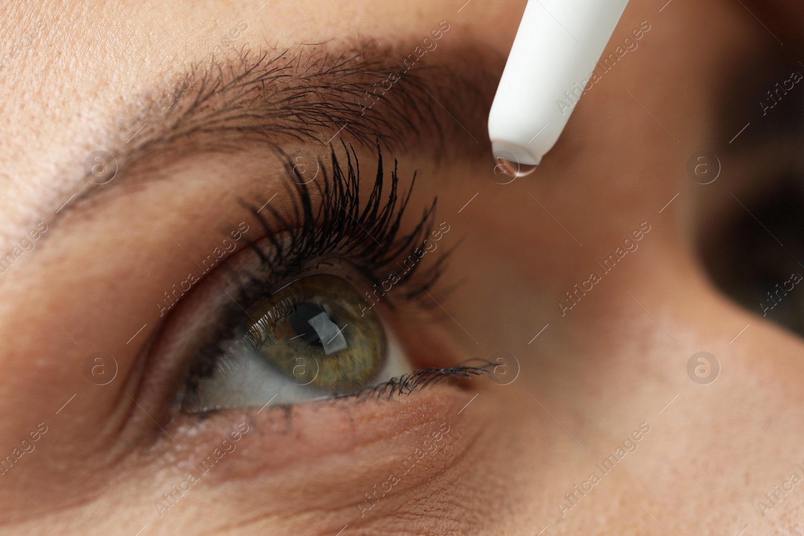 Photo of Woman applying medical eye drops, macro view