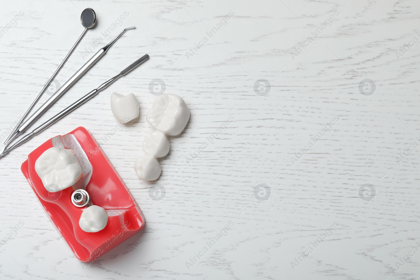 Photo of Educational model of gum with post for dental implant between teeth, crowns and medical tools on white wooden background, flat lay