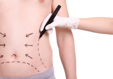 Photo of Doctor drawing lines on man's stomach with marker against white background