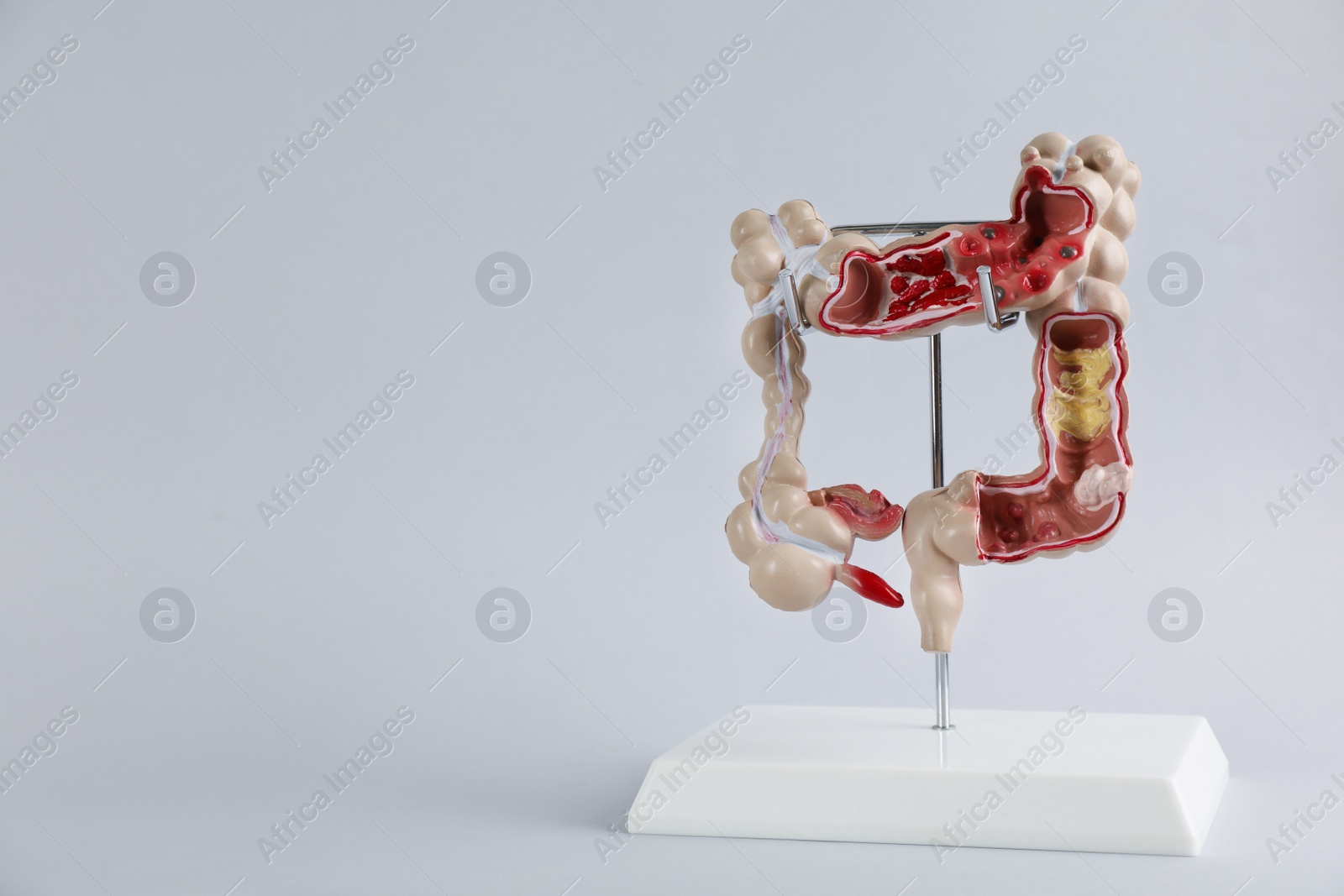 Photo of Human colon model on light grey background. Space for text