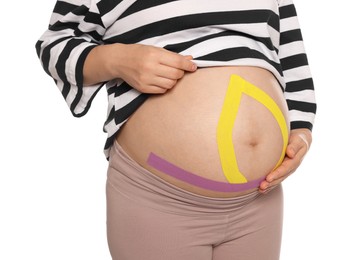 Photo of Pregnant woman with kinesio tapes on her belly against white background, closeup