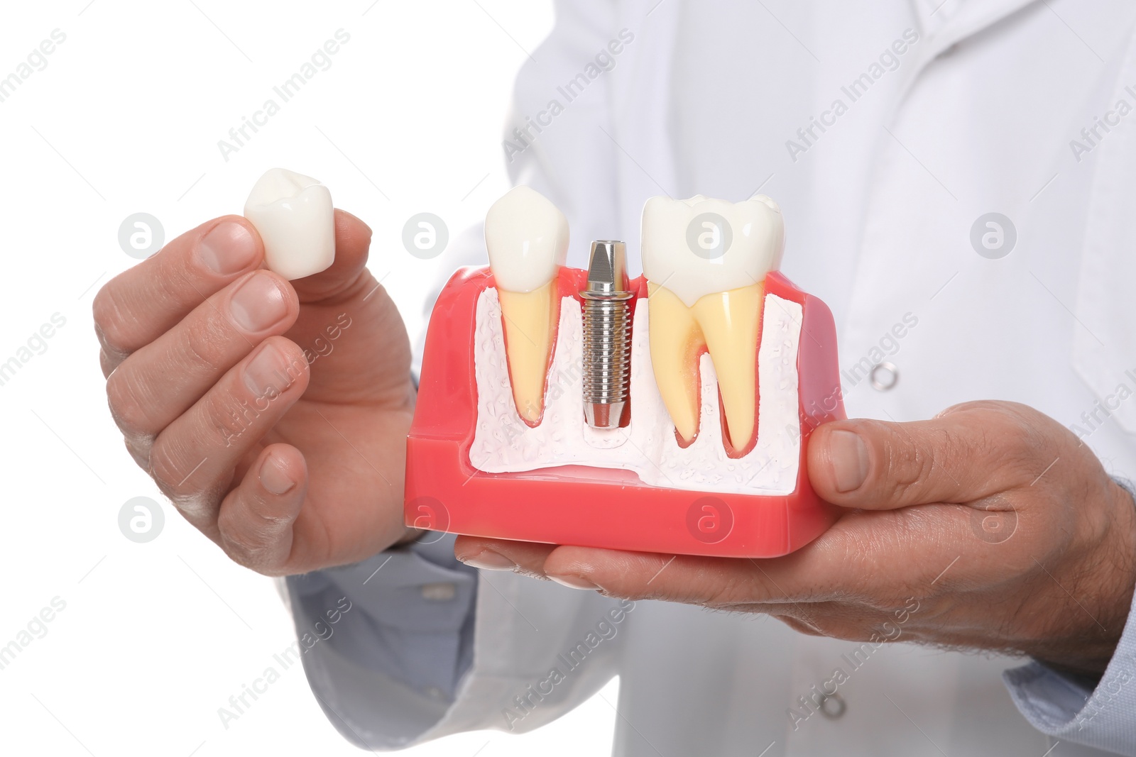 Photo of Dentist holding educational model of dental implant on white background, closeup