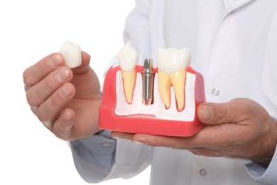 Photo of Dentist holding educational model of dental implant on white background, closeup