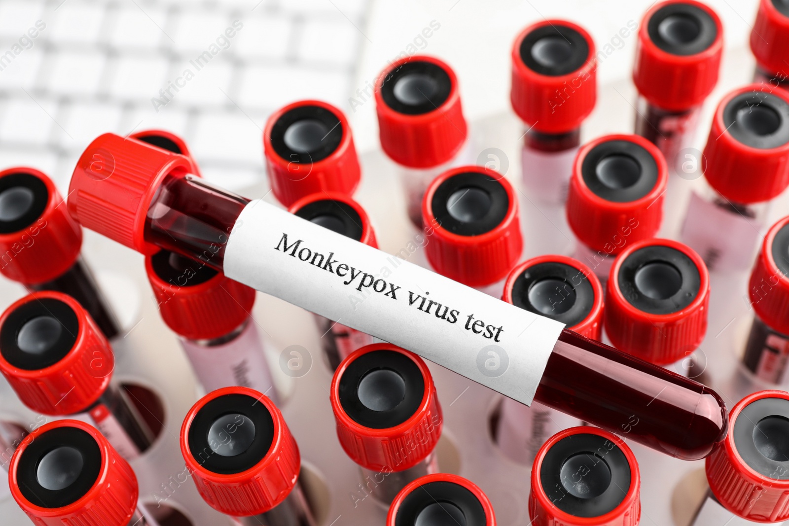 Photo of Monkeypox virus test. One sample tube with blood on others, closeup