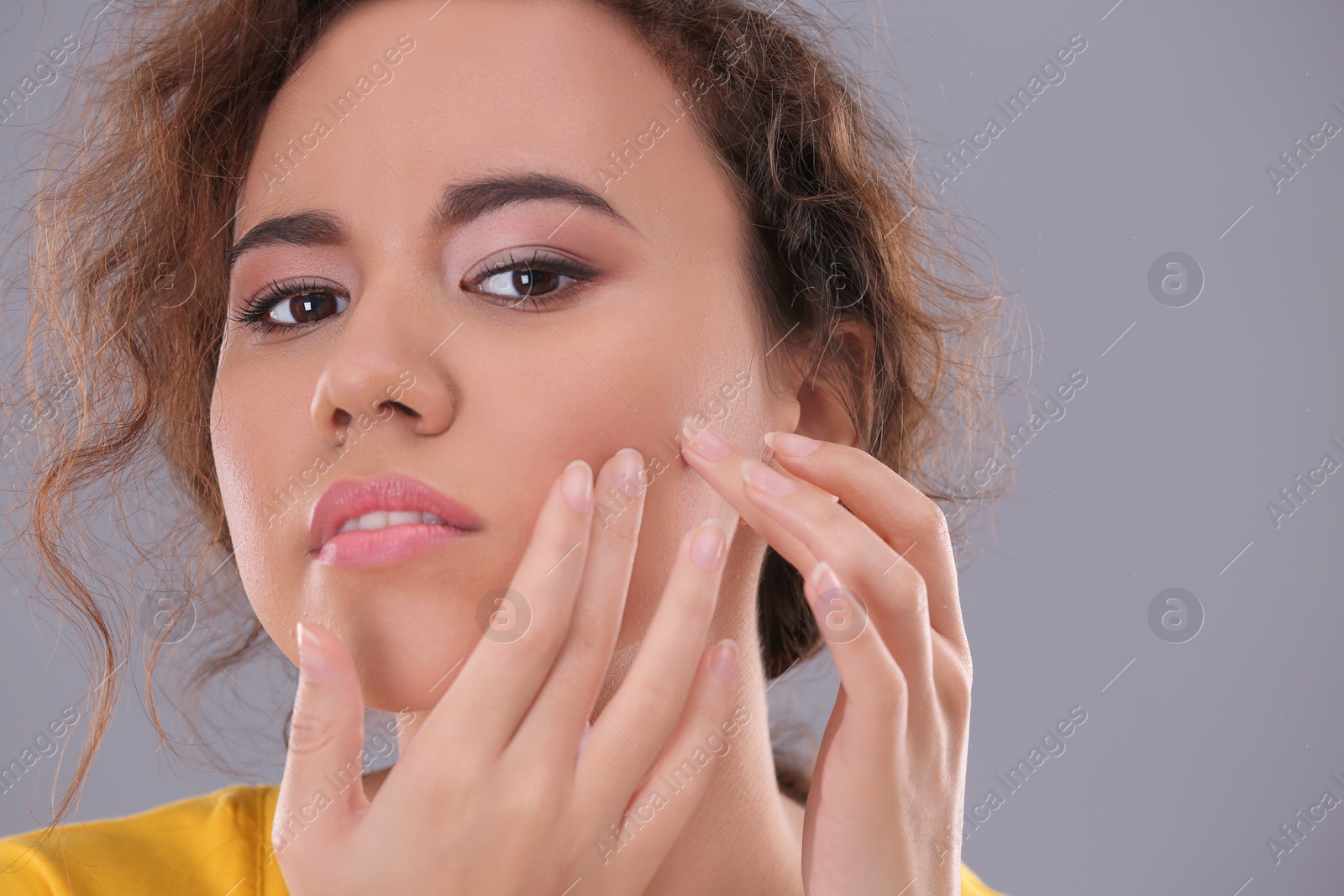 Photo of Beautiful young woman with acne problem on grey background