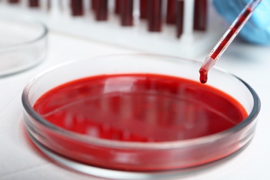 Pipetting blood into Petri dish for analysis on table in laboratory, closeup