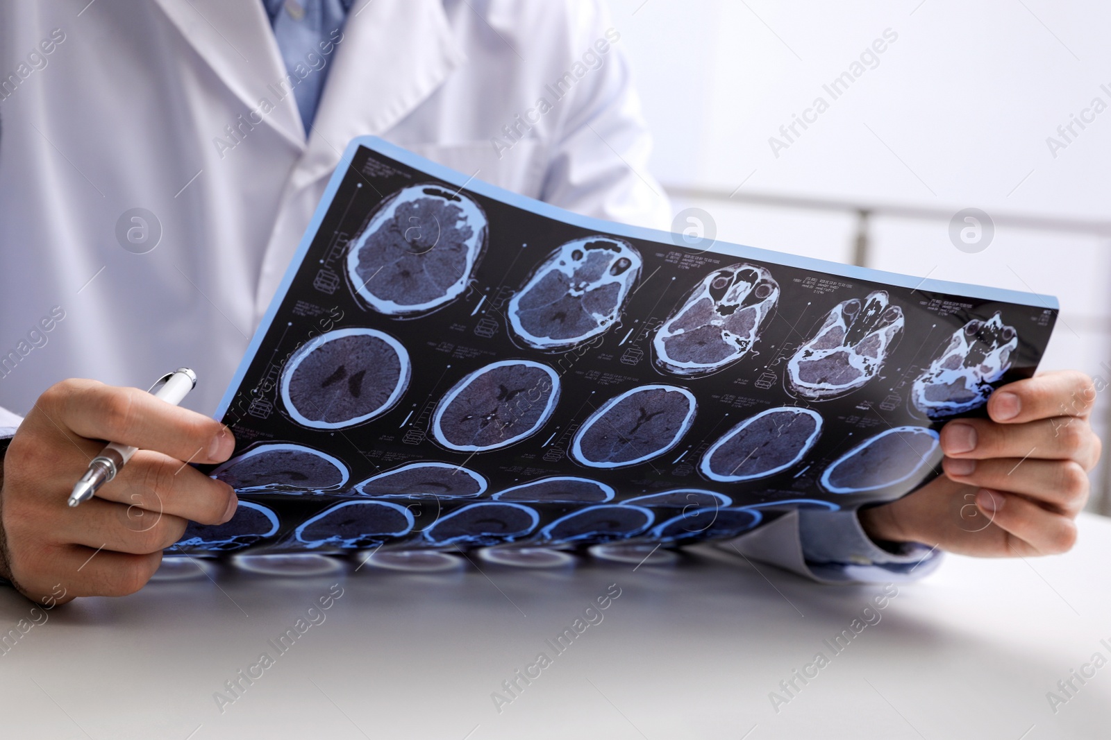 Photo of Doctor examining MRI images of patient with multiple sclerosis at table in clinic, closeup