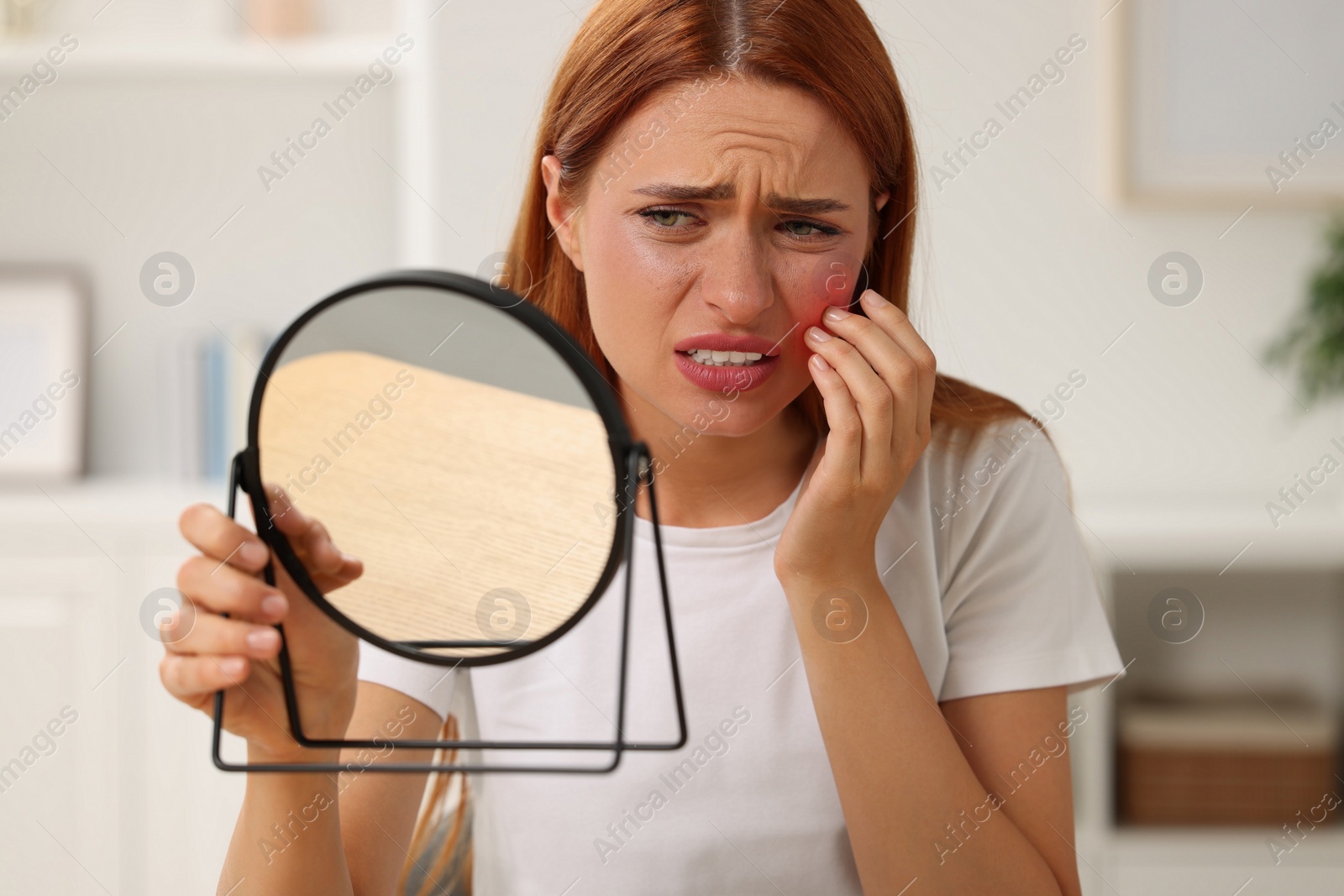 Photo of Suffering from allergy. Young woman looking in mirror and scratching her face at home