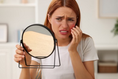 Suffering from allergy. Young woman looking in mirror and scratching her face at home