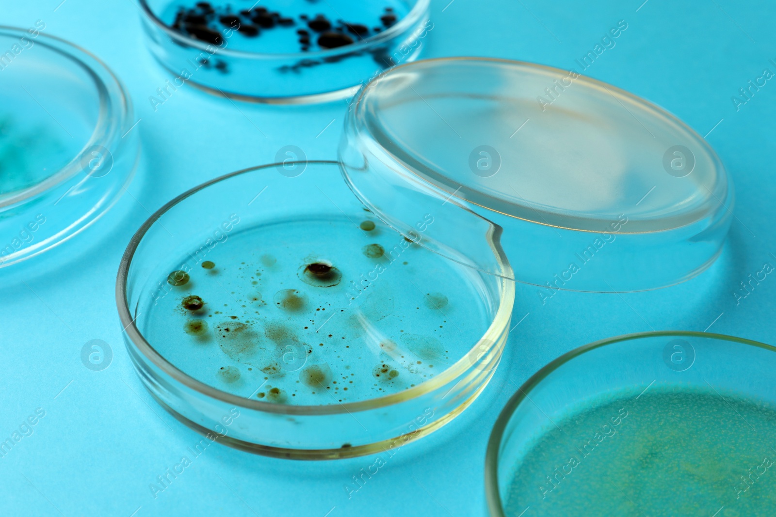 Photo of Petri dishes with different bacteria colonies on light blue background, closeup