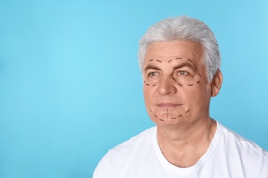 Mature man with marks on face for cosmetic surgery operation against blue background. Space for text