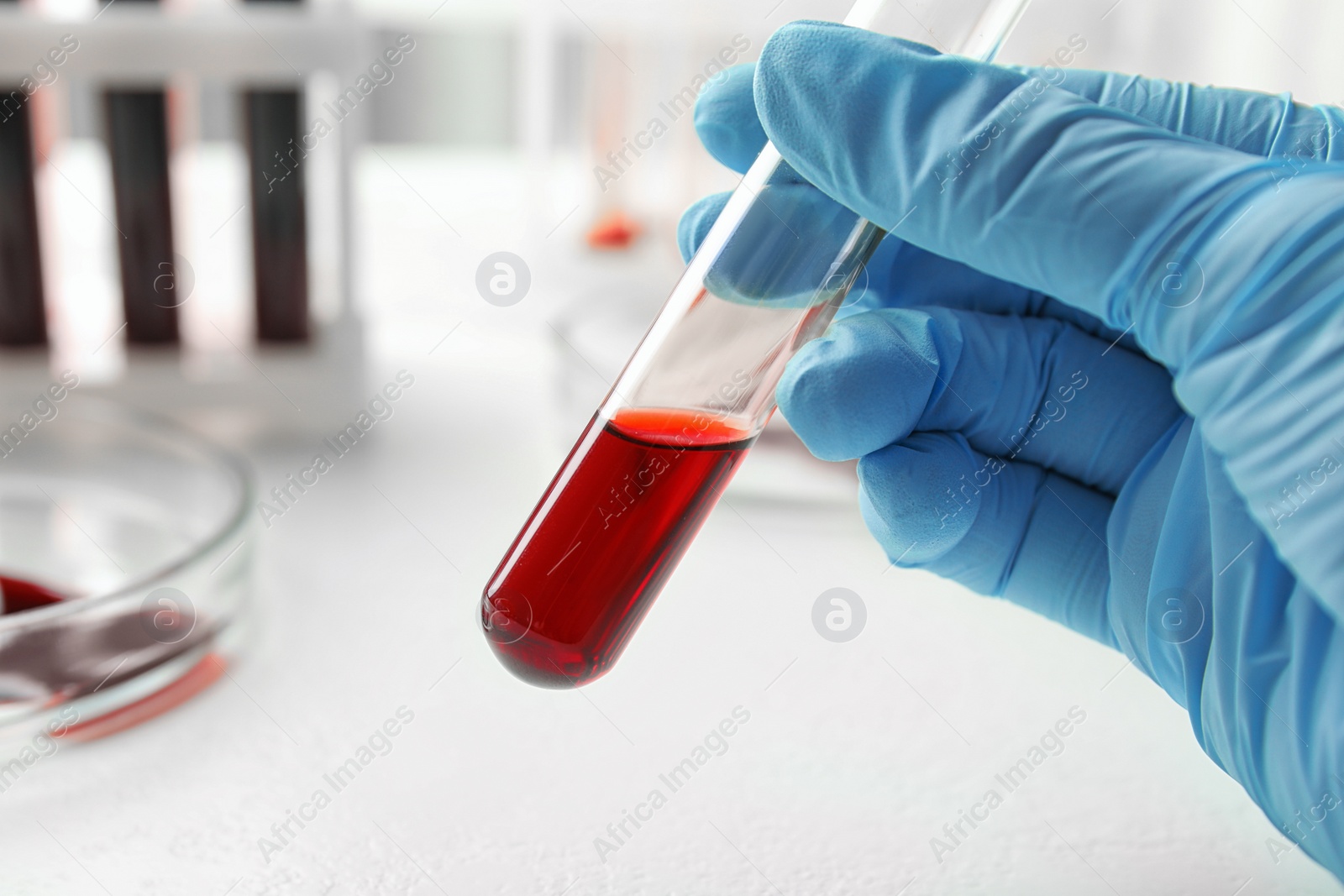 Image of Scientist holding test tube with blood sample, closeup. Laboratory analysis