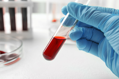 Scientist holding test tube with blood sample, closeup. Laboratory analysis