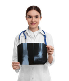 Photo of Orthopedist holding X-ray picture on white background