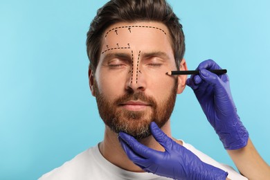 Image of Man preparing for cosmetic surgery, light blue background. Doctor drawing markings on his face, closeup